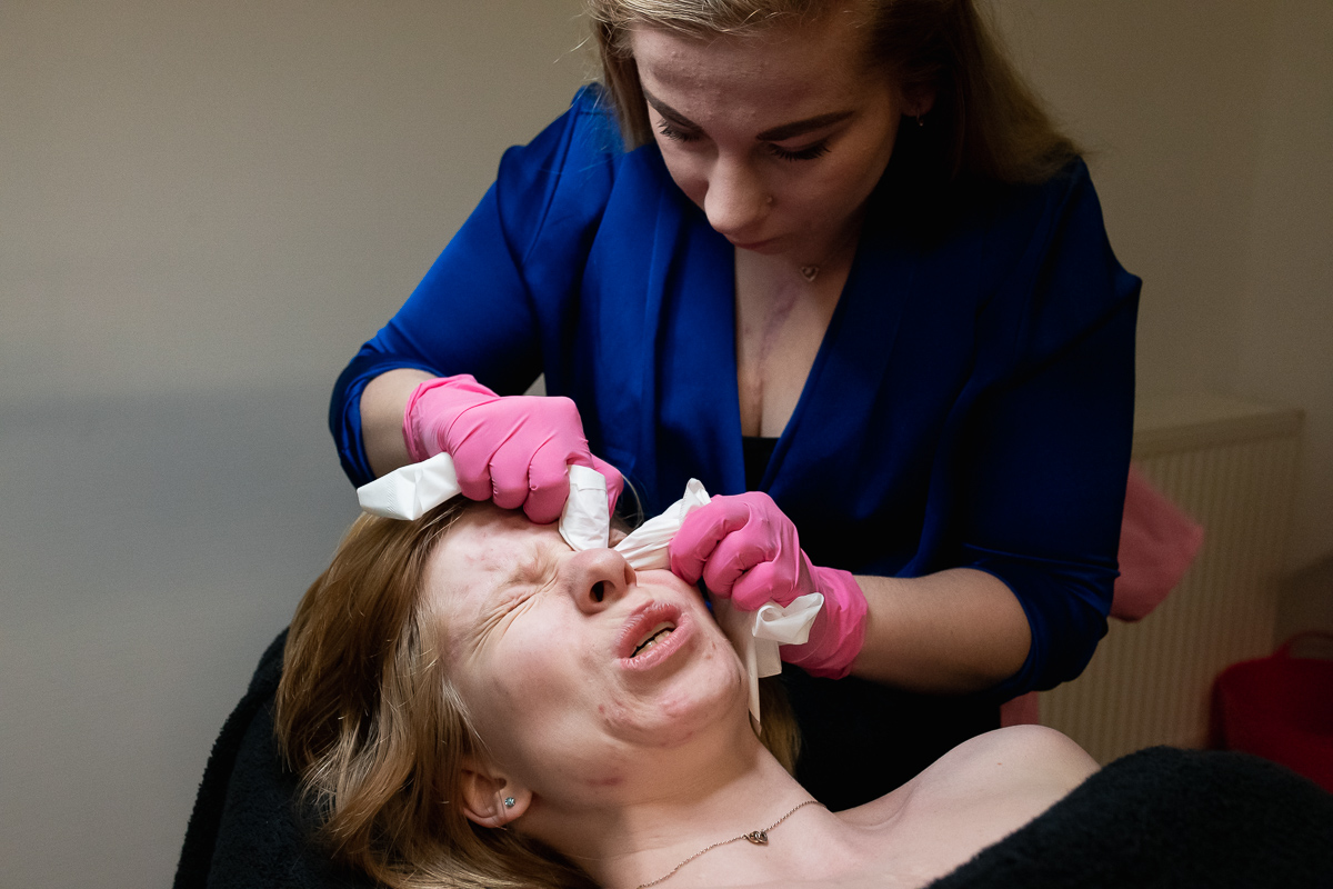 Eeneiige tweeling met een hartafwijking in Laura's Beautysalon Lauressie